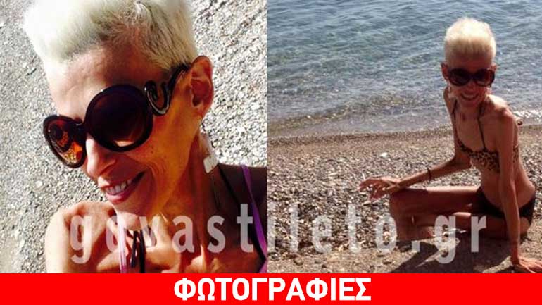 Η μεταμόρφωση της Νανάς Καραγιάννη: Άλλαξε, πήρε τα πάνω της και φόρεσε το μπικίνι της